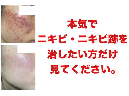 プランス 熊本(PLANCE)の写真