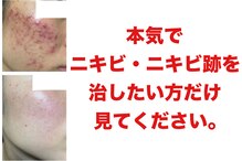 プランス 熊本(PLANCE)