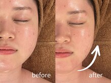 ヴィヴァンポー(VIVANPOR)の雰囲気（効果を即実感！施術後に鏡を見て驚きの変化を◎）