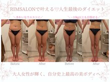 リムサロン(RIMSALON)/RIMSALONで叶える☆