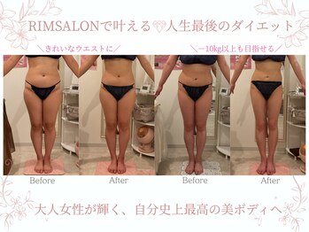 リムサロン(RIMSALON)/RIMSALONで叶える☆