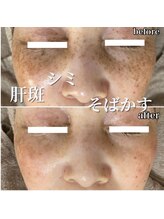 セリー(Celie)/お客様症例