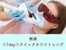 《1day》クイックホワイトニング  ¥25,900→¥24,000