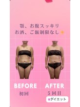 ヨサパーク ラブリエ 吉祥寺店(YOSA PARK La Briller)/40代　水素まみれコース