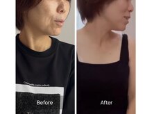 ウテナ(UTENA)/空ルート×整体1回の変化