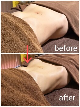 リラックスココ(Relax KOKO)/骨盤から整えるHOT腸もみ