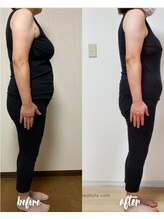 エステサロン エクラ/