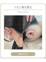 ミース 上野店/髪を上げても安心！