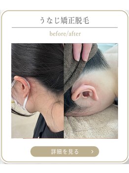 ミース 上野店/髪を上げても安心!