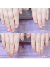 プライズアイリス アイラッシュ 池袋東口店(prize Iris eyelash)/深爪改善【池袋】