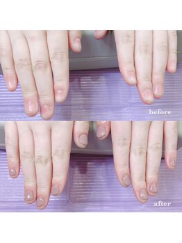 プライズアイリス アイラッシュ 池袋東口店(prize Iris eyelash)/深爪改善【池袋】