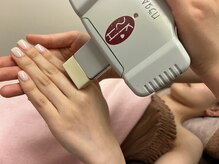 エイミー なんば店(ei-me)/【脱毛サロン/脱毛】手甲指脱毛