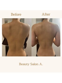 エードット 銀座(A.)/before → after