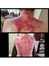 オアシス(OASIS)/ホット★カッサ