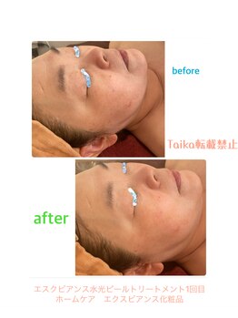 タイカ(Taika)/くすみ改善ケア◎