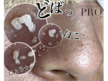 セミル(SEMIRU)