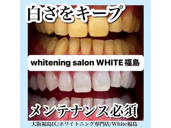 ホワイトニングサロン ホワイト(WHITE)/セルフホワイトニング/大阪/福島