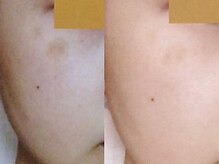 フルリール/【UVプロテクション】