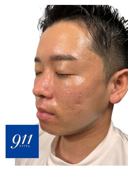 水素ジム911 心斎橋/韓国肌管理*ララピール¥4,800