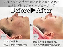 何をしたらいいか分からず、悩んでいる方は是非カウンセリングへ