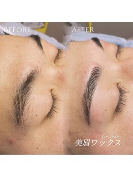 エイティピカル(Atypical)の写真/骨格に合わせ左右差を整える施術で、あなたの雰囲気に似合わせを追求◎