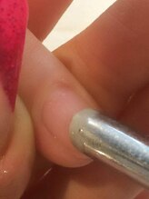 お爪の表面に溜まった垢や古い角質