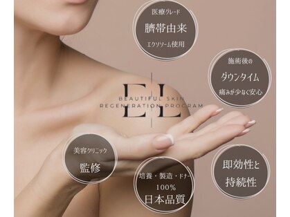 プリュネル(Prunelle)の写真