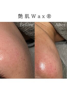 ビューティービューティー(BEAUTY BEAUTY)/