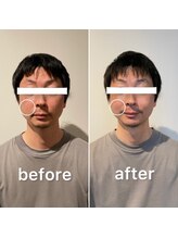 リユーア(Re:youa)/before→after