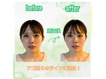 リコア(Re`core)の雰囲気（小顔矯正はシルエット変化だけでなく、表情が作りやすくなる！）