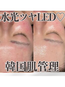 ミタメ 銀座店(MITAME)/渡韓せずに肌管理ができる♪