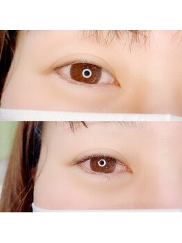 ルピナス 武蔵小金井店(Lupinus)/LEDフラットラッシュ120本