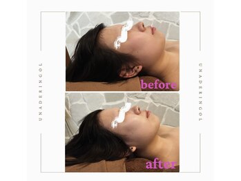 ウナ デ リンゴル 恵比寿店(UNA de Ringol)/当日から効果あり!!