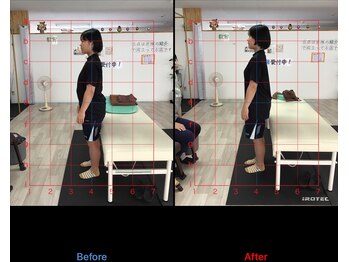 ストレチックス 近江八幡店/姿勢改善ビフォーアフター1回