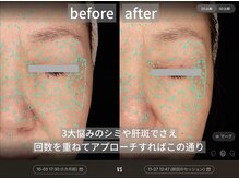 ダイヤモンドトゥルース(Diamond truth)の雰囲気（シミケアも効果をご実感いただいています。）
