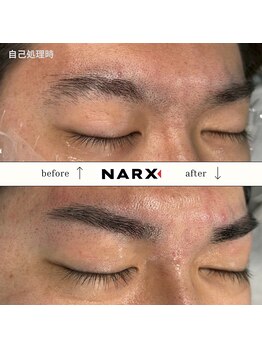 ナークス(NARX)/【メンズ眉毛】ビフォーアフター