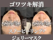 マヴィ 守口店(MavY.)/スノーピーリングジェルパック