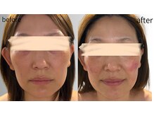 リズ(rE:S)/トータルケアで韓国ツヤ肌！40代