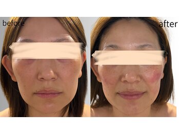 リズ(rE:S)/トータルケアで韓国ツヤ肌!40代