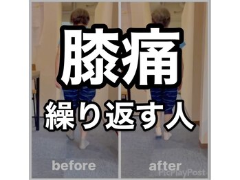 カワル整体 上通り院/膝痛繰り返す人