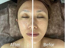 クレール(clair)/インディバフェイシャル