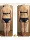 水玉サロン(水玉Salon)の写真/最新ハイパーナイフ7完備◎しっかり丸ごと7部位+オイルマッサージ９０分の贅沢コース。