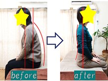 奏流(soryu)/頑固な猫背・巻き肩もこの変化☆