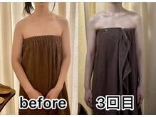 ビュール 銀座(BeauL)/ブライダルエステ