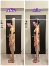 トータルボディセラピーハート(Heart)/真っ直ぐ立ったつもりが傾いてる