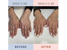 ネイルズニコ(Nails nico)の雰囲気（手の浮き出た血管が気になる人におすすめ奇跡のトリートメント）