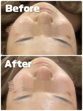 エメ(Eme.)/【フェイシャル】施術の変化！