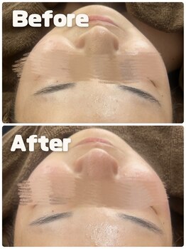 エメ(Eme.)/【フェイシャル】施術の変化！