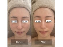 ラリュンヌ(La Lune)/パールマーメイドトリートメント