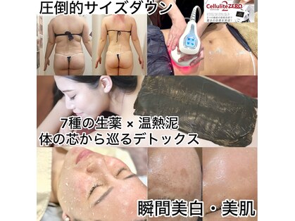 フローレンス(Florence)の写真